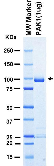 The purity was assessed by SDS-PAGE/CBB staining.